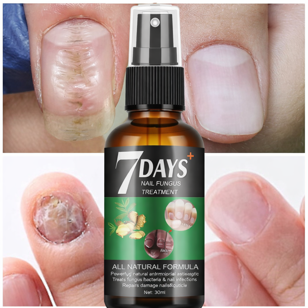 7 Dias Tratamiento de uñas | Elimina Hongos y protege tus uñas™
